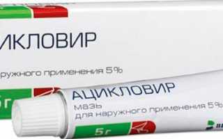 Почему появляется белый налет и зуд на головке у мужчин?