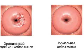 Выделения после секса — нормально ли это?