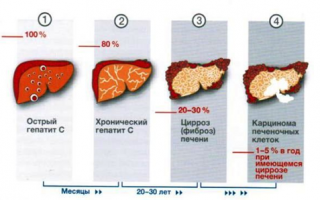 Что значит 1 генотип гепатита С и чем он опасен?