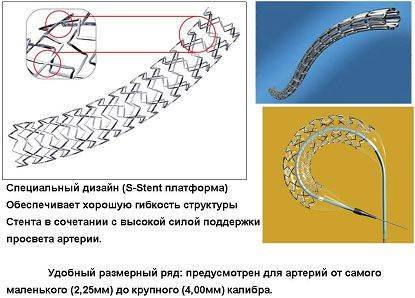 Виды стентов